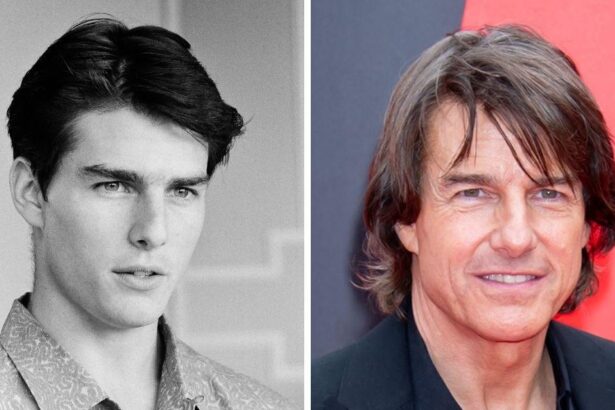 Has Tom Cruise Had Plastic Surgery? See Before & After Photos