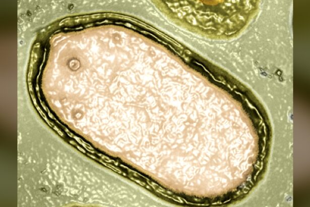 Hundreds of Mysterious Giant Viruses Discovered Lurking in The Ocean : ScienceAlert