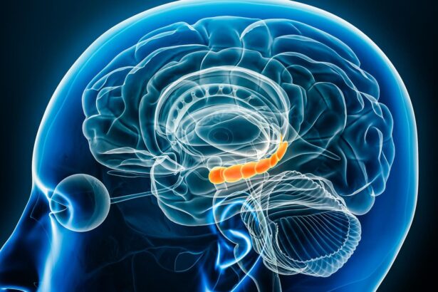 Inactivity Is Bad For Your Brain Health