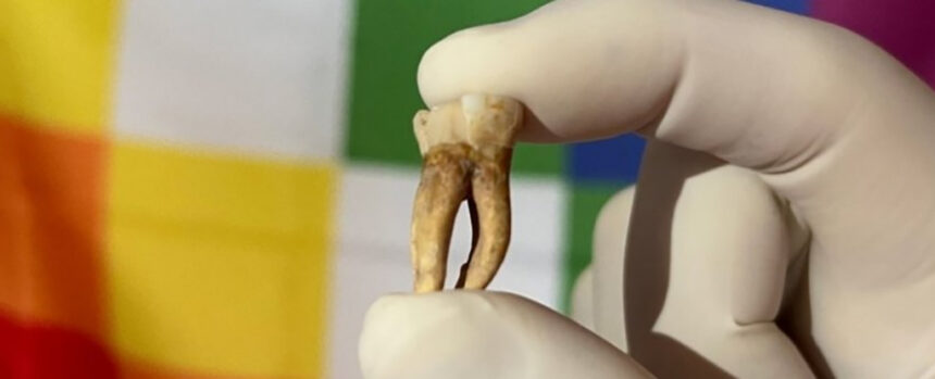 Leprosy Was Lurking in The Americas Long Before Colonization, Study Finds : ScienceAlert