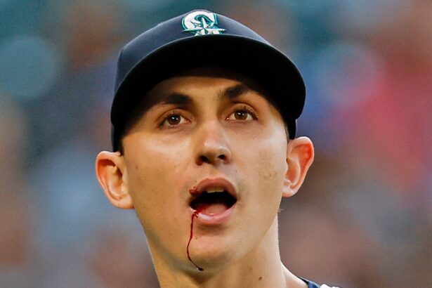 MLB Star George Kirby Hit In Mouth By 102.7 MPH Line Drive, Leaves Game Bloodied