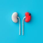 My Kidney Cancer Taught Me That Patients Aren’t Consumers