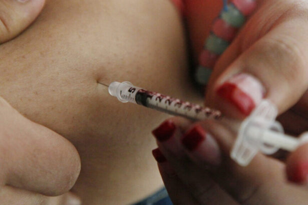 Off-the-shelf stem cell therapy for type 1 diabetes yields more positive results