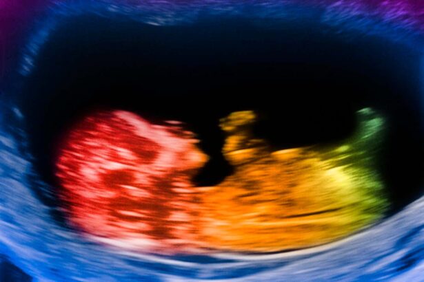 Our big brains may have evolved because of placental sex hormones