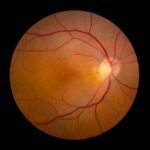 Retinal implant restores sight for blind mice
