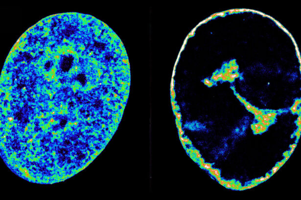 See how the herpesvirus reshapes our cells’ DNA in just eight hours