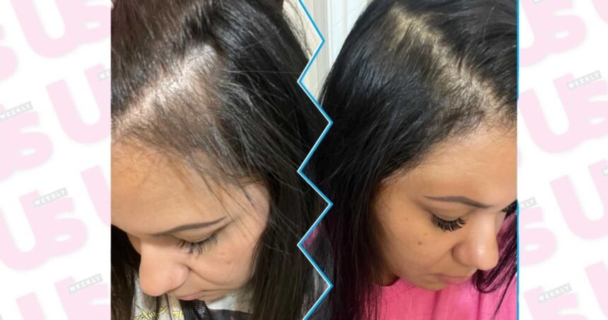 Shoppers in Their 50s Love This  Shampoo and Conditioner Set