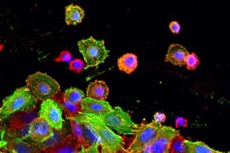Study finds exercise can keep colon cancer from recurring
