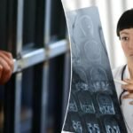 Surprising, controversial link between brain injuries, crime