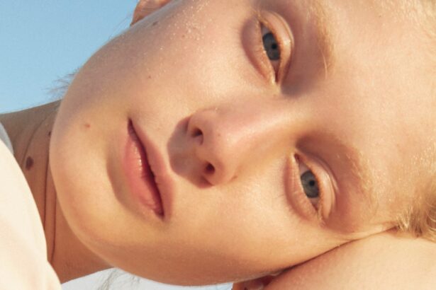 Body Acne: How to Treat It and Prevent Breakouts From Happening in the First Place