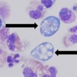 Texas Woman Dies From Brain-Eating Amoeba After Flushing Sinuses : ScienceAlert