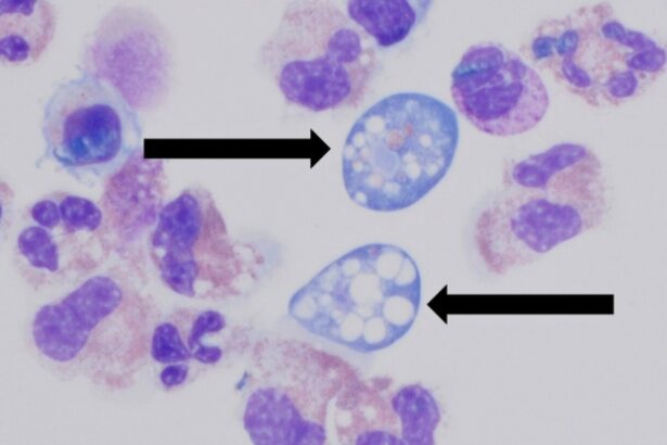 Texas Woman Dies From Brain-Eating Amoeba After Flushing Sinuses : ScienceAlert