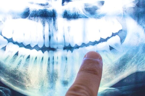 The Cause of Alzheimer’s Might Be Coming From Within Your Mouth : ScienceAlert