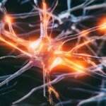 The Sad Case of The World’s Youngest-Ever Alzheimer’s Diagnosis : ScienceAlert