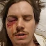 Trump-Hating Agitator Shot in the Eye After Thugs Violently Assault Police Officers During “No Kings” Riot in Los Angeles |