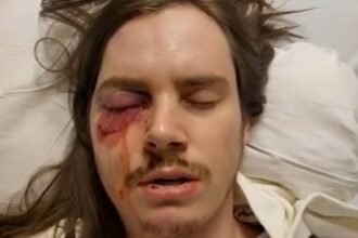 Trump-Hating Agitator Shot in the Eye After Thugs Violently Assault Police Officers During “No Kings” Riot in Los Angeles |
