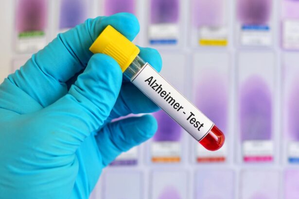 Why Blood Test For Early Detection Of Alzheimer’s Disease Matters