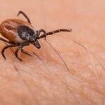 Why Lyme disease and other tick-borne conditions are on the rise