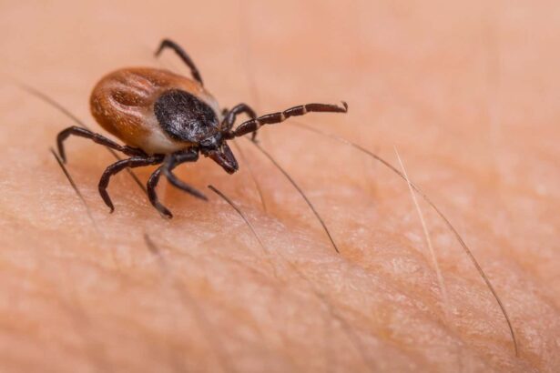 Why Lyme disease and other tick-borne conditions are on the rise