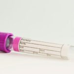 Alzheimer’s Association clears way for new diagnostic blood tests