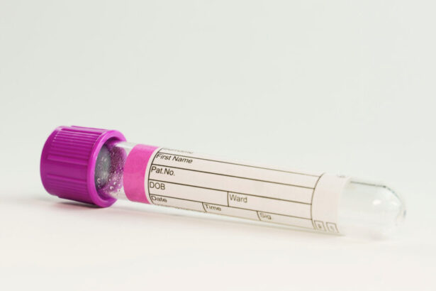 Alzheimer’s Association clears way for new diagnostic blood tests