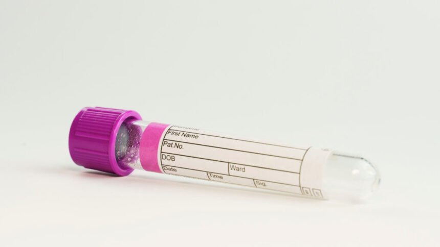 Alzheimer’s Association clears way for new diagnostic blood tests