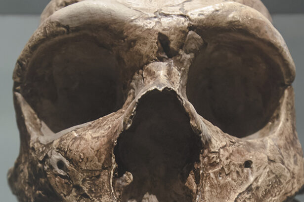 Brain Abnormality in Modern Humans Linked to Ancient Neanderthal DNA : ScienceAlert