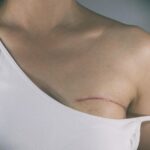 Breast Cancer Rates Are Rising. Here’s How AI Can Assess Your Risk