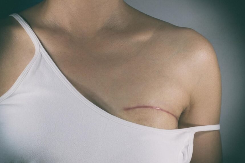 Breast Cancer Rates Are Rising. Here’s How AI Can Assess Your Risk