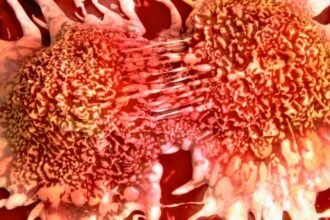 Common Viruses May Wake Dormant Breast Cancer Cells, Study Finds : ScienceAlert
