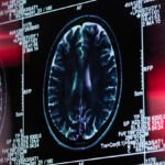 Dementia Linked With Treatment For Chronic Lower Back Pain : ScienceAlert