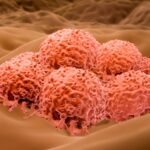 Herpes virus could soon be approved to treat severe skin cancer