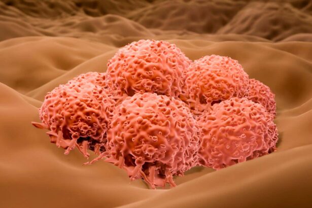 Herpes virus could soon be approved to treat severe skin cancer