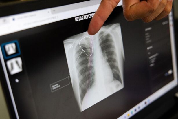 How AI Is Accelerating The Fight Against An Ancient Killer