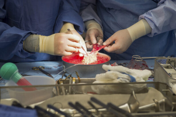 Kidney transplant rejection: Researchers find ‘groundbreaking’ clue