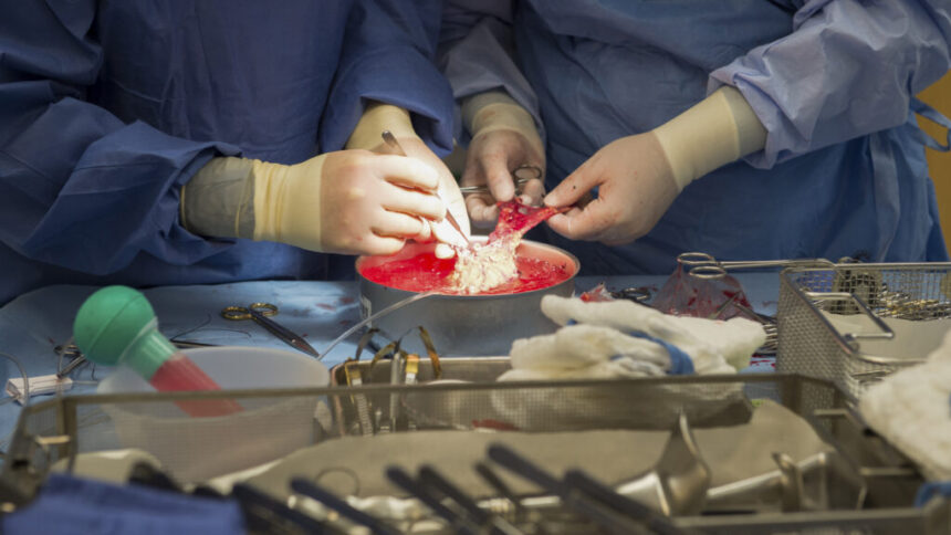Kidney transplant rejection: Researchers find ‘groundbreaking’ clue
