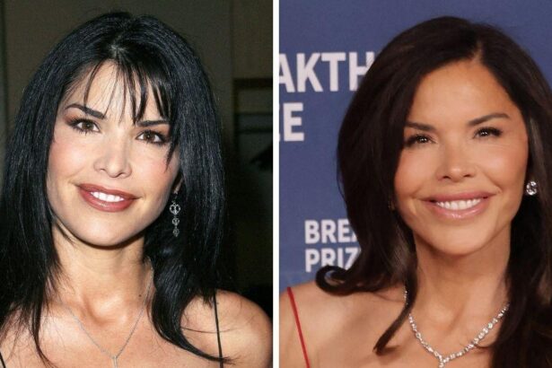 Lauren Sanchez’s Plastic Surgery: Before & After Photos