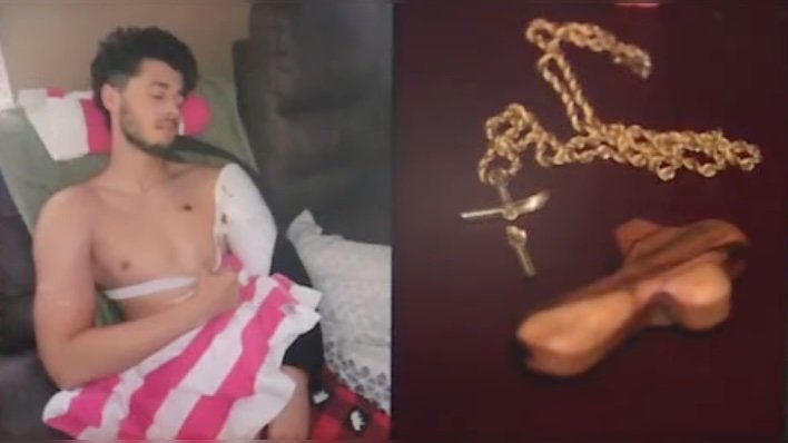 Miracle: Florida Man Gives God Glory After Cross Necklace Blocks Bullet from Hitting Heart |