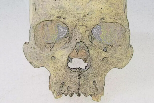 Mysterious Leprosy Pathogen Has Lurked in The Americas For 4,000 Years : ScienceAlert