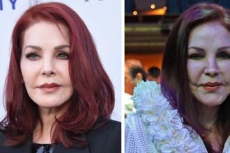 Priscilla Presley’s Plastic Surgery Nightmare! Fillers and More
