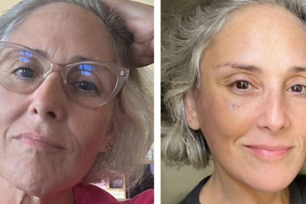 Ricki Lake Boasts About Neck and Facelift After Losing 40 Pounds