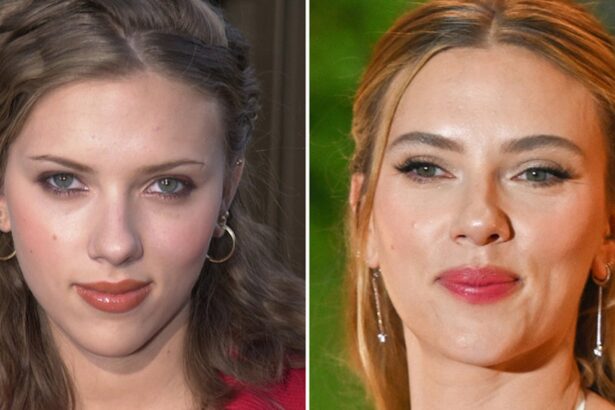 Scarlett Johansson — Good Genes or Good Docs?!