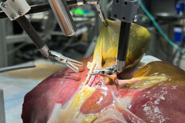 Surgical robots take step towards fully autonomous operations