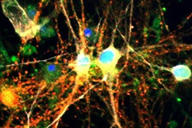 Surprise Discovery About Sugar in The Brain Could Help Fight Alzheimer’s : ScienceAlert