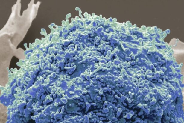 ‘Trash’ in your blood might help spot cancer early, scientists say