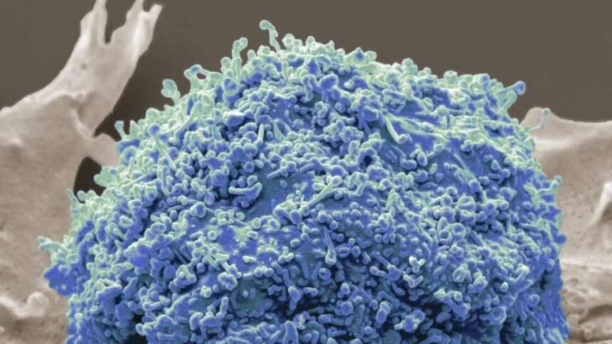 ‘Trash’ in your blood might help spot cancer early, scientists say