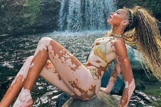 Winnie Harlow Sexy Shots To Kick Off Her 31st Bday!