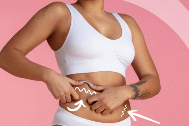 How Cryolipolysis Can Help Freeze Your Fat