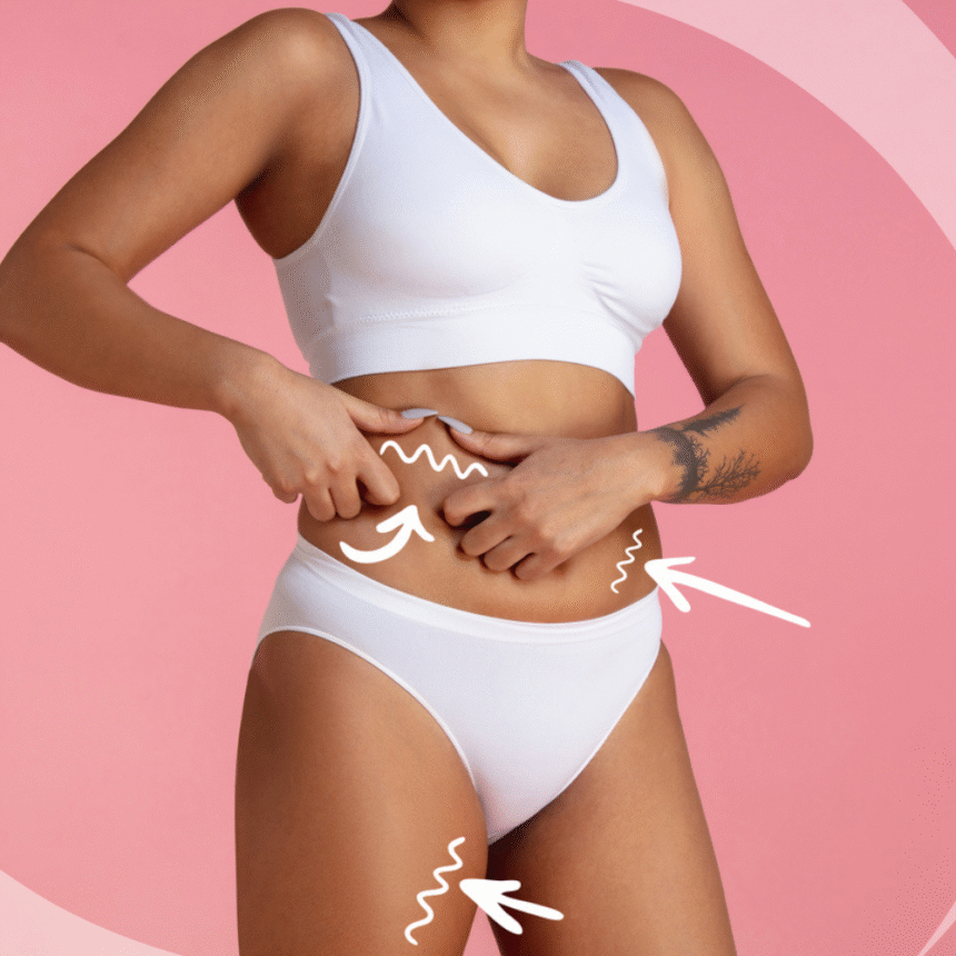 How Cryolipolysis Can Help Freeze Your Fat