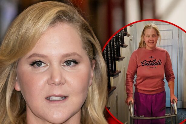 Amy Schumer Shares Photo Using Walker After Spinal Surgery